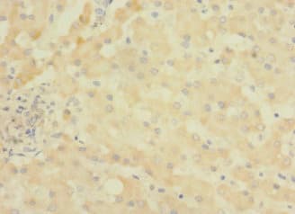 ASPHD1 Antibody