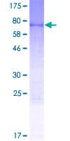 Human NOB1 / NOB1P Protein (Recombinant GST)