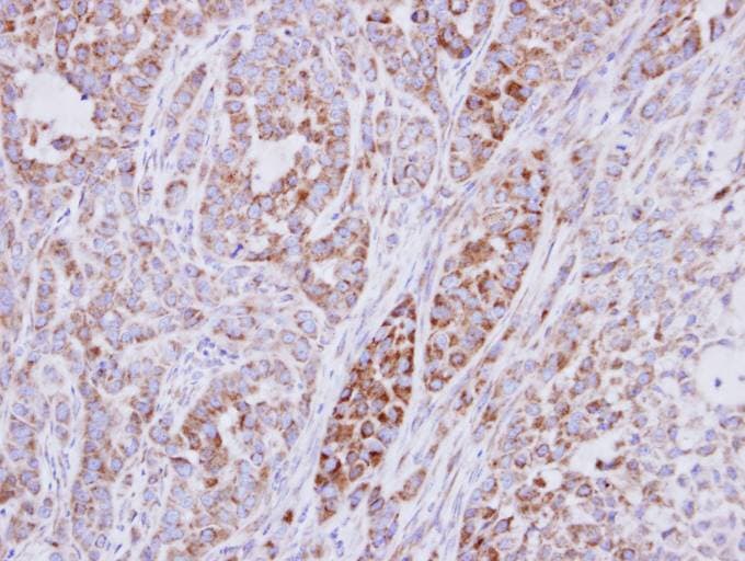 RPS10 / Ribosomal Protein S10 Antibody (aa1-151)