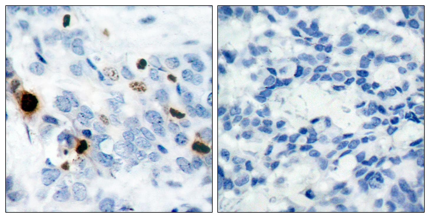 Histone H3.1 Antibody (phospho-Ser10)