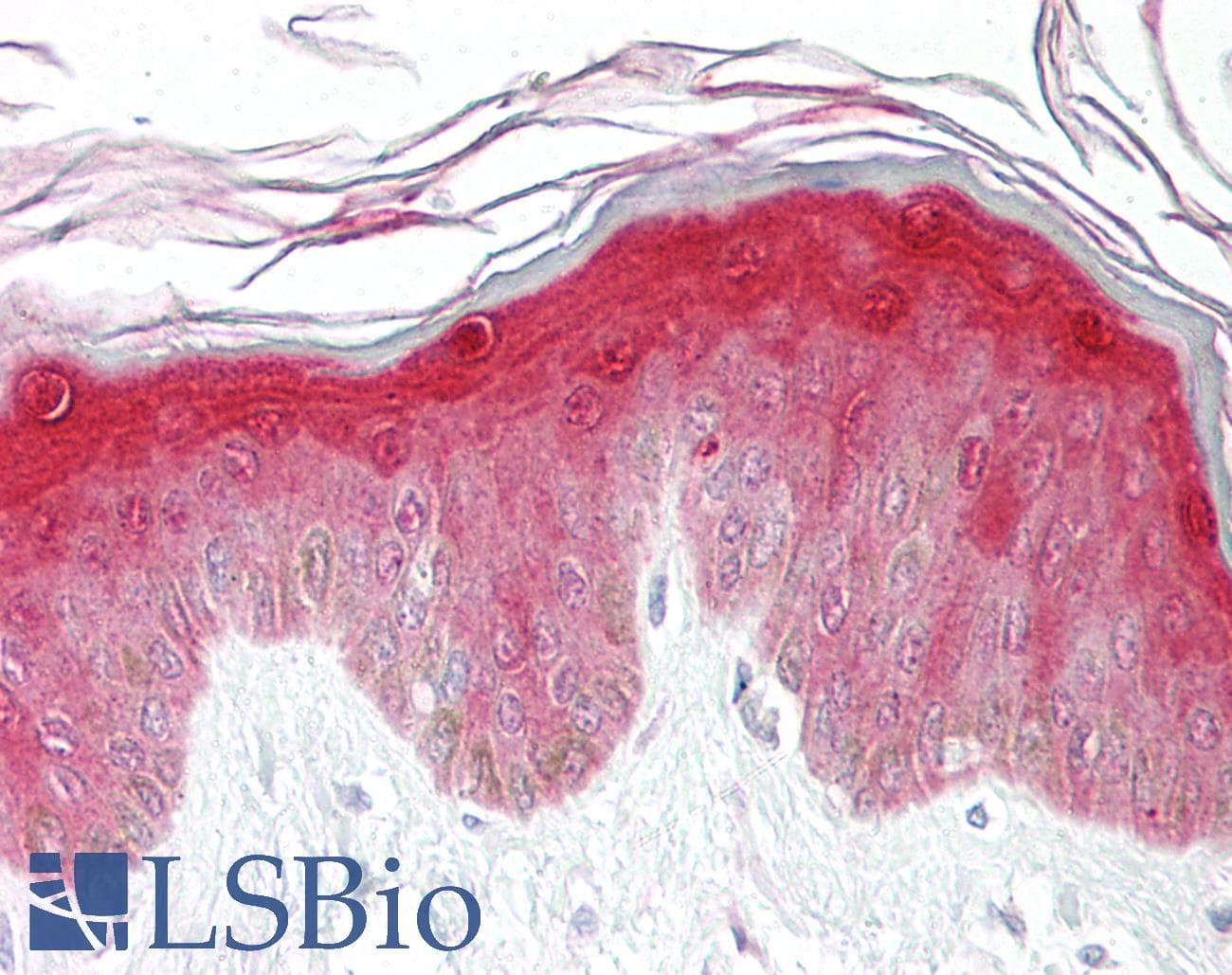 IHC-plus™ HSPB1 / HSP27 Antibody (aa45-94)