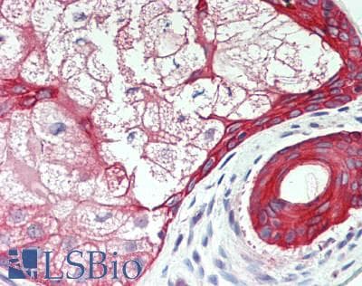 IHC-plus™ Polyclonal Rabbit anti-Human KRT34 / Keratin 34 / KRTHA4 Antibody (aa1-303, IHC, IF, WB)