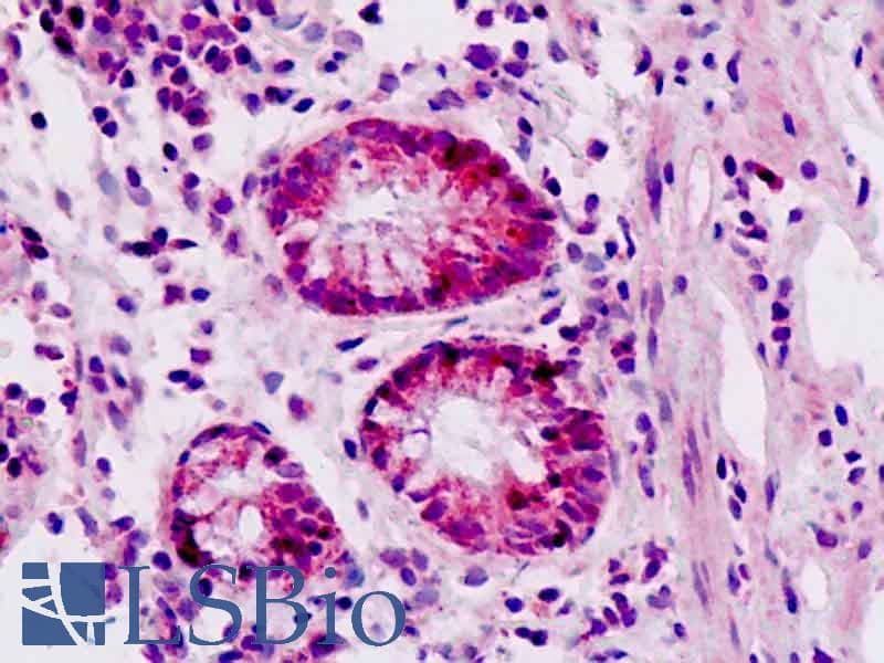 IHC-plus™ EPHA3 / EPH Receptor A3 Antibody (aa115-144)