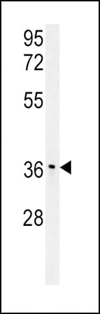 Polyclonal Rabbit anti-Human IGFBP3 Antibody (Ser183, IHC, WB)