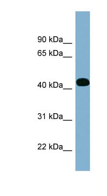 Polyclonal Rabbit anti-Human ITPK1 Antibody (aa179-228, WB)