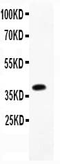 CAV2 / Caveolin 2 Antibody (aa1-162)