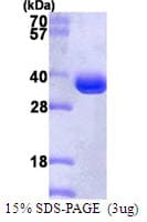 Human PSMA1 Protein (Recombinant His)
