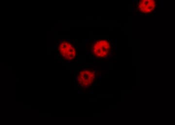 Polyclonal Rabbit anti-Human ELK1 Antibody (phospho-Ser389, IHC, IF, WB)