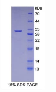 Human DFFB Protein (Recombinant His-T7)