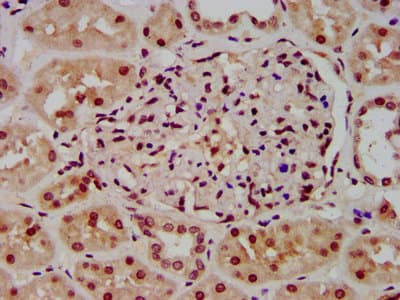 Polyclonal Rabbit anti-Human HIST1H3A Antibody (IHC, IF)