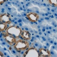 Polyclonal Rabbit anti-Human DIAPH1 Antibody (IHC, WB)