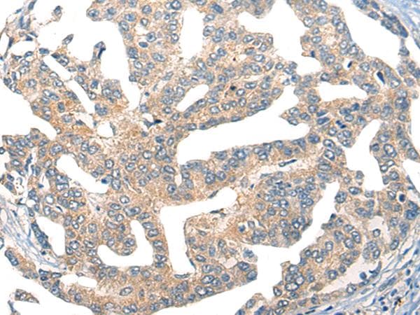 GPR55 Antibody