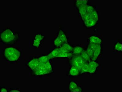 PCA1 / ALKBH3 Antibody (aa1-170)
