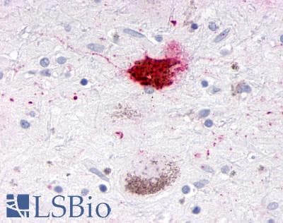 PathPlus™ Polyclonal Rabbit anti-Human NR1D1 Antibody (Internal, IHC)