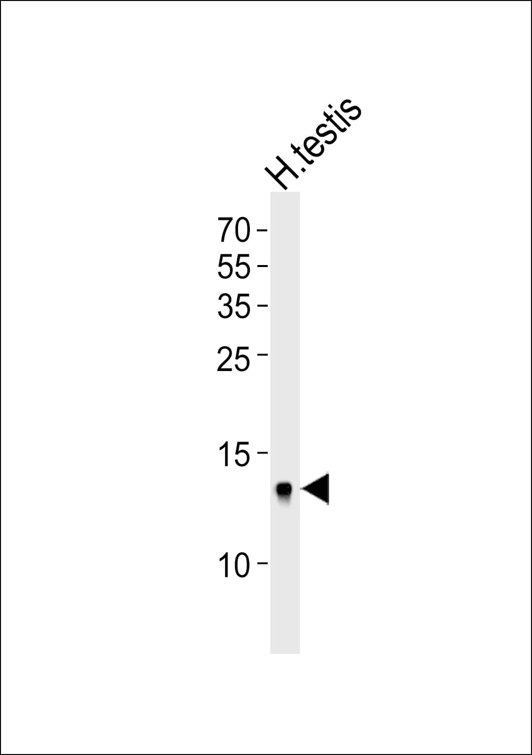 DEFB107A Antibody (C-Terminus)