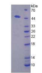 Human Renal Dipeptidase / DPEP1 Protein (Recombinant His-T7)