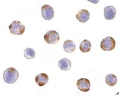 IHC-plus™ Polyclonal Rabbit anti-Human NOD2 / CARD15 Antibody (IHC, IF, WB)