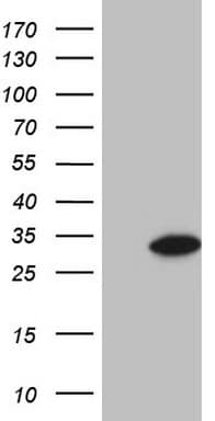 GLYAT Antibody (clone OTI4D1)