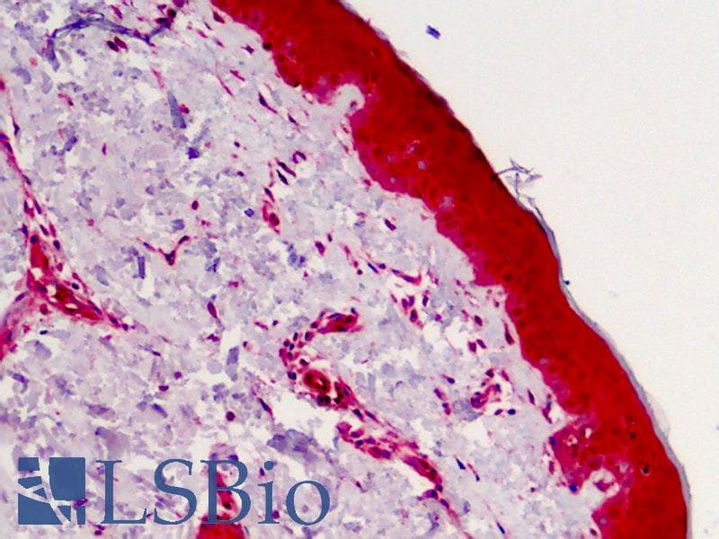 IHC-plus™ Polyclonal Rabbit anti-Human CASP4 / Caspase 4 Antibody (IHC, WB)