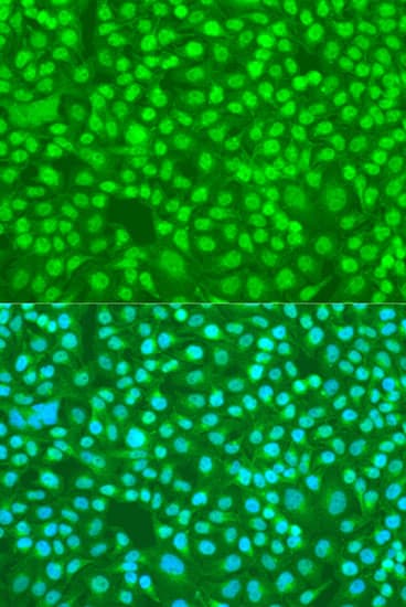 SRSF9 / SFRS9 Antibody