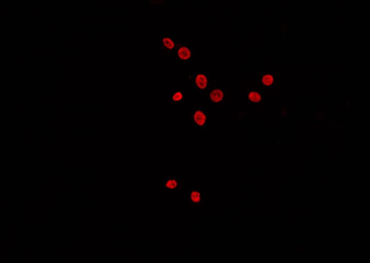 TP53BP1 / 53BP1 Antibody