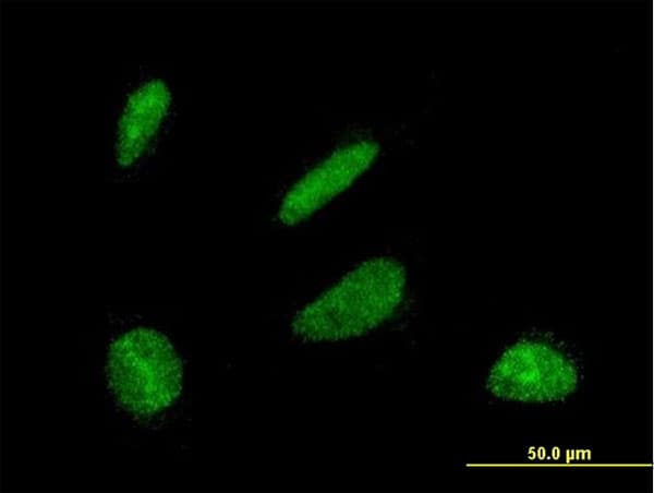 DBF4 Antibody (clone 6G9)