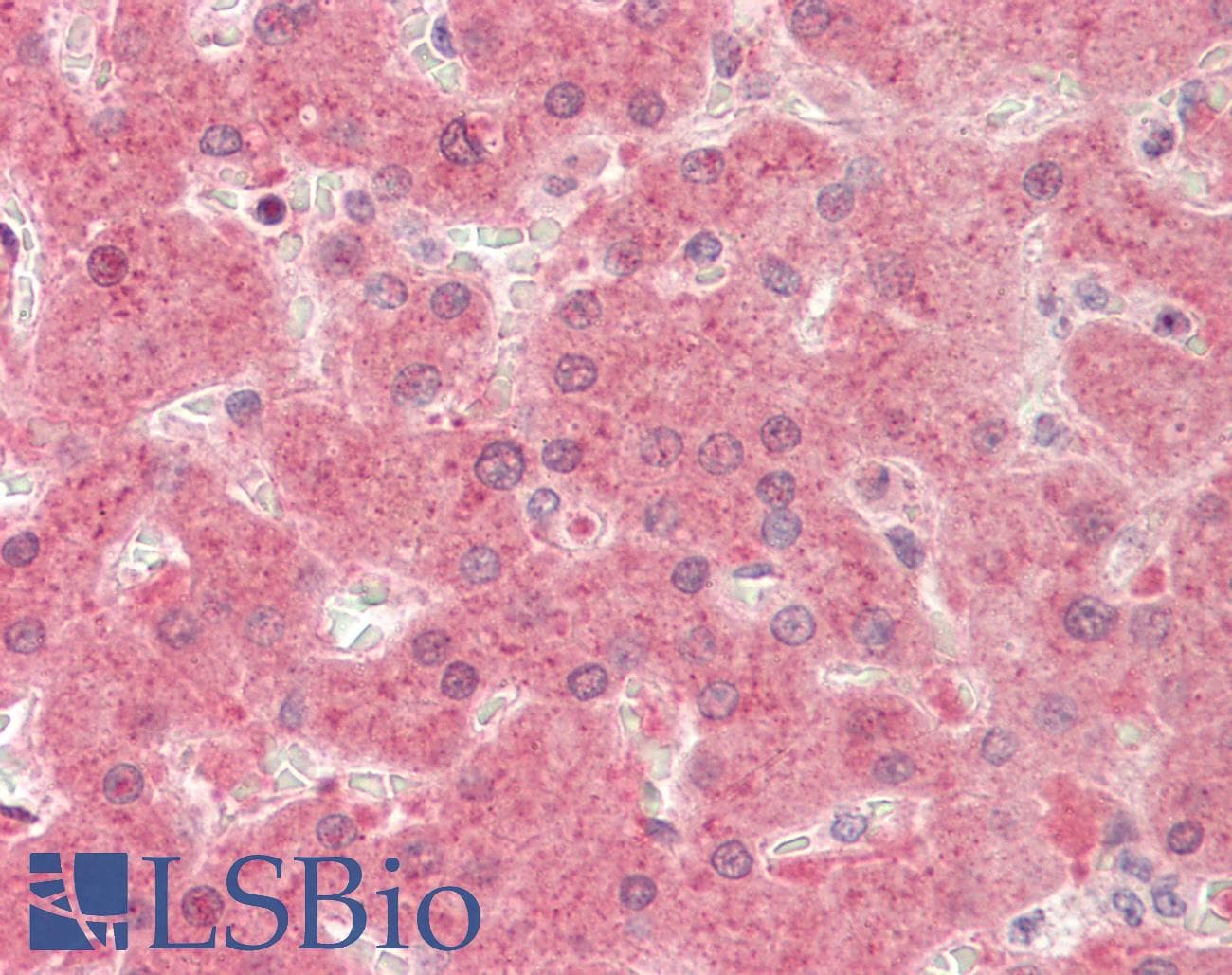 IHC-plus™ Polyclonal Rabbit anti-Human PIK4CB / PI4KB Antibody (Internal, IHC, WB)