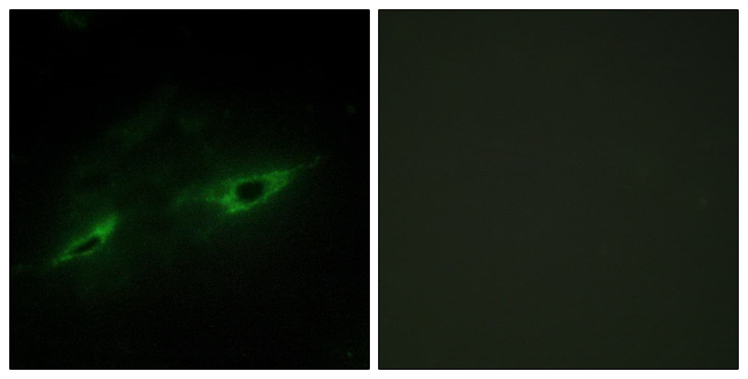 CDH22 / Cadherin 22 Antibody (aa111-160)