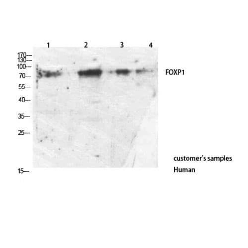 Polyclonal Rabbit anti-Human FOXP1 Antibody (C-terminal, WB)