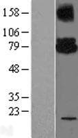 UBE2G2 Protein (Over-Expression Lysate Myc-DDK (Flag))