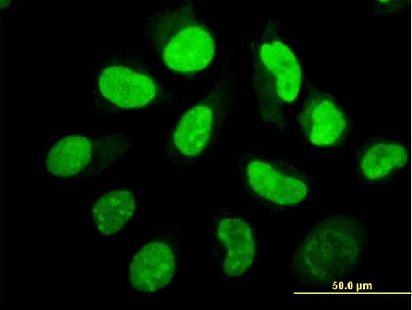 EIF2AK2 / PKR Antibody (clone 1D11)
