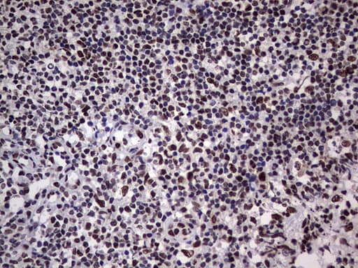HNRNPL / hnRNP L Antibody (aa270-502, clone OTI9F11)