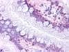 IHC-plus™ Polyclonal Rabbit anti-Human Prostaglandin D2 Receptor Antibody (Cytoplasmic Domain, IHC)