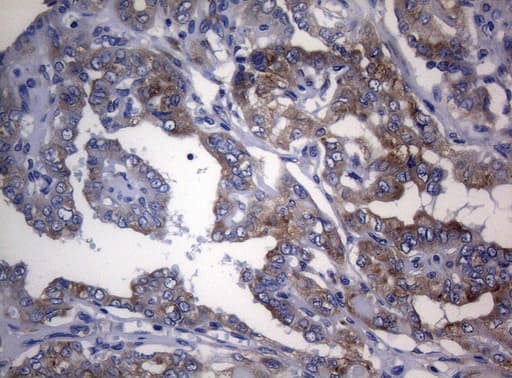 RPL10 / Ribosomal Protein L10 Antibody (clone OTI9A8)