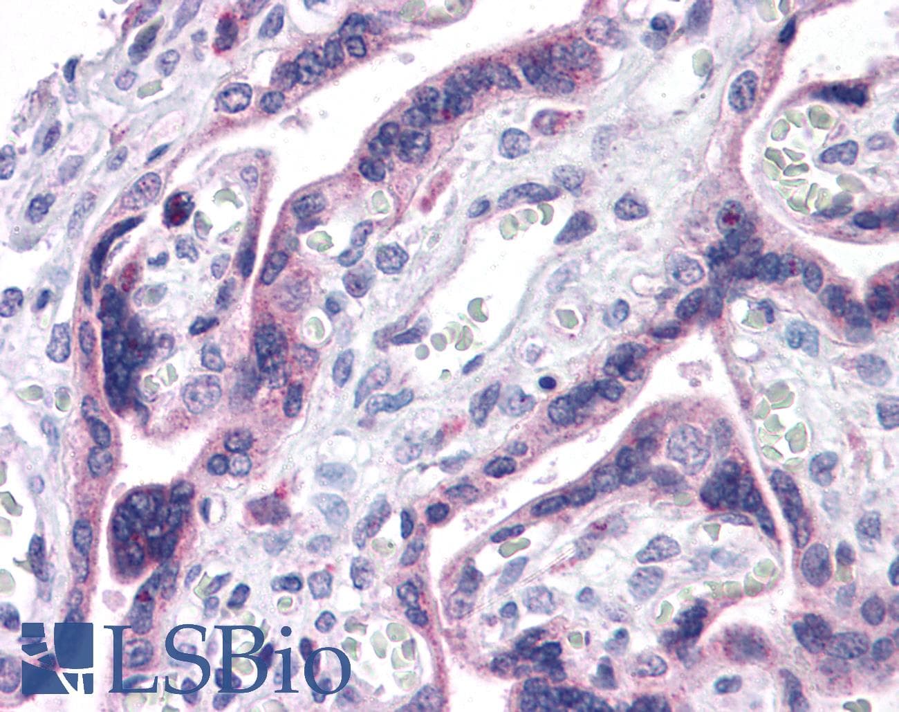 IHC-plus™ PTCHD2 Antibody