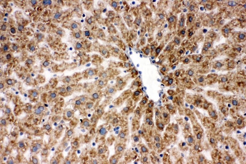 Polyclonal Rabbit anti-Human HSPA9 / Mortalin / GRP75 Antibody (aa591-609, IHC, WB)