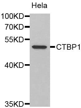 Polyclonal Rabbit anti-Human CTBP1 / CTBP Antibody (WB)