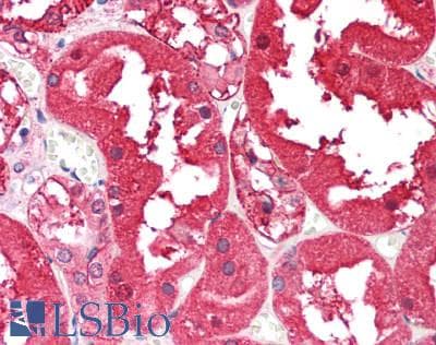 IHC-plus™ Monoclonal Mouse anti-Human AKR1A1 Antibody (clone 10E11, IHC, WB)