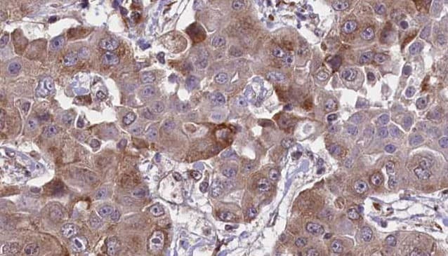 HFE Antibody