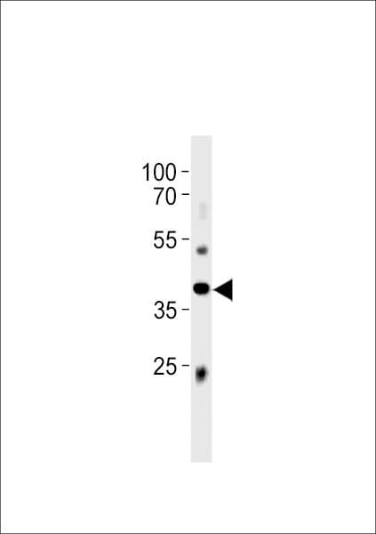 Polyclonal Rabbit anti-Mouse ABI3 Antibody (aa300-329, WB)