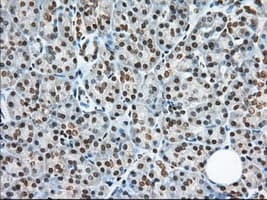 ERIC-1 / TACC3 Antibody (clone OTI1E8)
