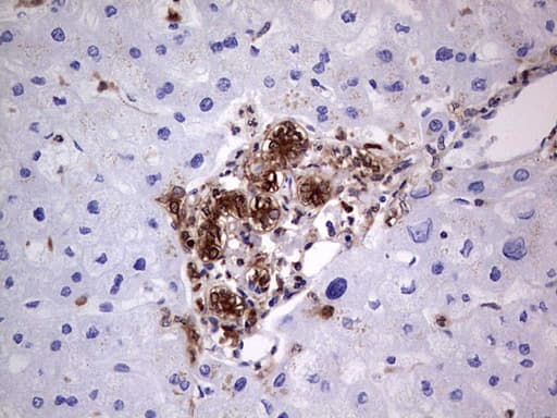 Monoclonal Mouse anti-Human LGALS3 / Galectin 3 Antibody (clone OTI15E4, IHC, WB)