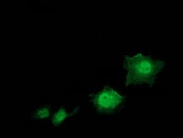 IHC-plus™ STAT5A Antibody (clone 4E7)