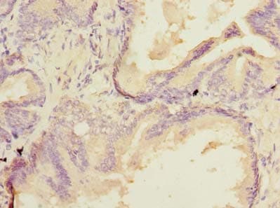 Polyclonal Rabbit anti-Human SSR3 / TRAP-Gamma Antibody (IHC, WB)
