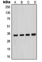 MNAT1 Antibody (Internal)