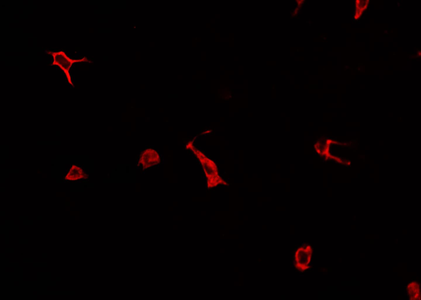 RAB27A / RAB27 Antibody