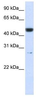 PGLS / 6PGL Antibody (C-Terminus)