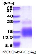 Human MT3 / Metallothionein 3 Protein (Recombinant His)