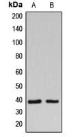 B3GALT1 Antibody (Internal)