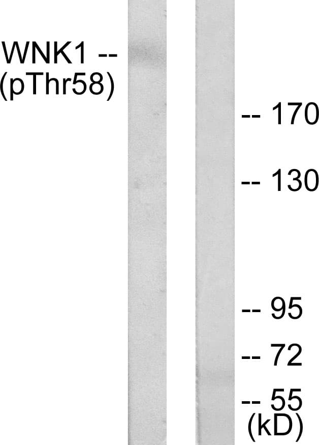 WNK1 Antibody (phospho-Thr58)
